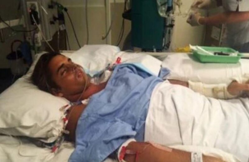 Surfista demanda estado por diente de tiburón que mordió su pierna Surfista demanda estado por diente de tiburón que mordió su pierna