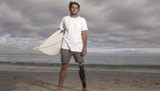 Surfista demanda estado por diente de tiburón que mordió su pierna