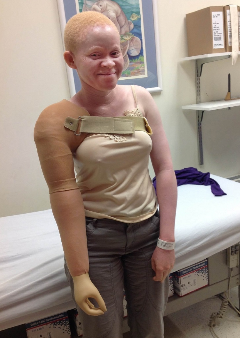 Tanzanian albinos, whose bodies are worth more than gold