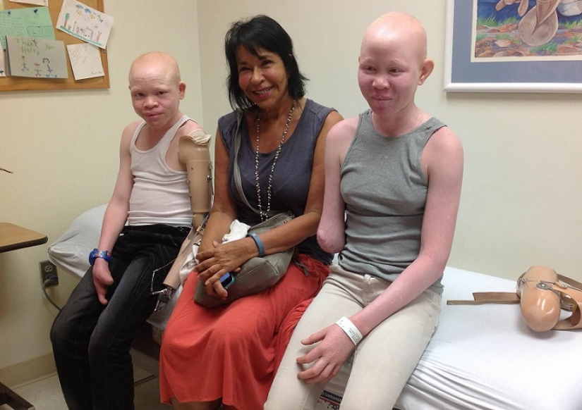 Tanzanian albinos, whose bodies are worth more than gold