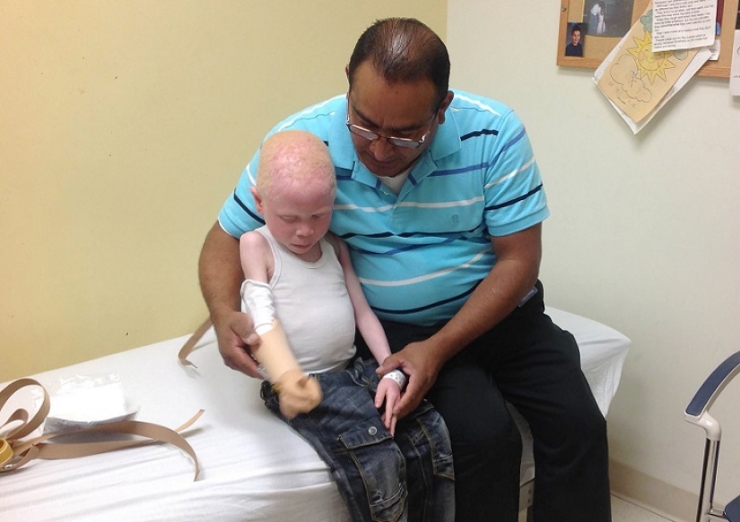 Tanzanian albinos, whose bodies are worth more than gold