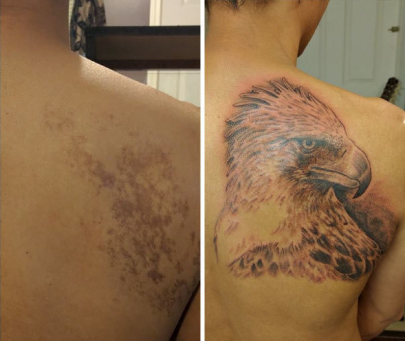 Tatuajes que esconden marcas de nacimiento