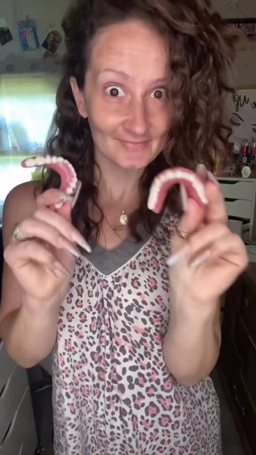 The American lost all her teeth at the age of 21, but remained confident, thanks to her husband