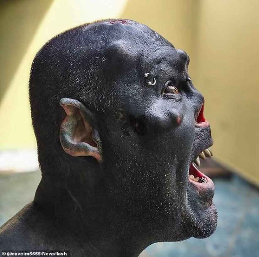 The Brazilian tattoo artist transforms into an orc by removing the nose, mutilating the ears and getting the tattoo in blue. The Brazilian tattoo artist transforms into an orc by removing the nose, mutilating the ears and getting the tattoo in blue.