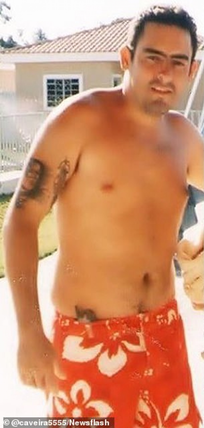 The Brazilian tattoo artist transforms into an orc by removing the nose, mutilating the ears and getting the tattoo in blue. The Brazilian tattoo artist transforms into an orc by removing the nose, mutilating the ears and getting the tattoo in blue.