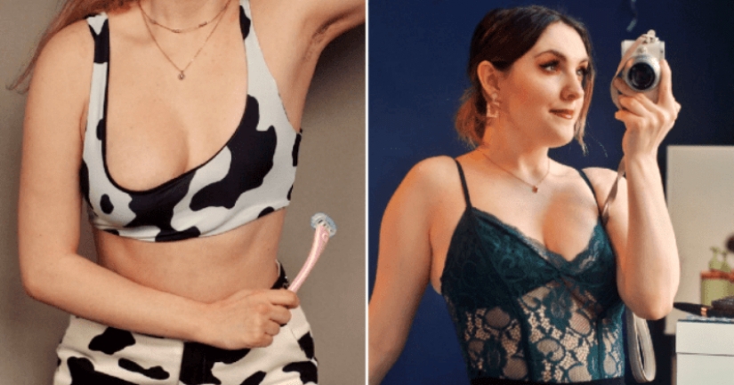 The Englishwoman, due to a rare disease, grew only one breast, but this did not make her unhappy The Englishwoman, due to a rare disease, grew only one breast, but this did not make her unhappy