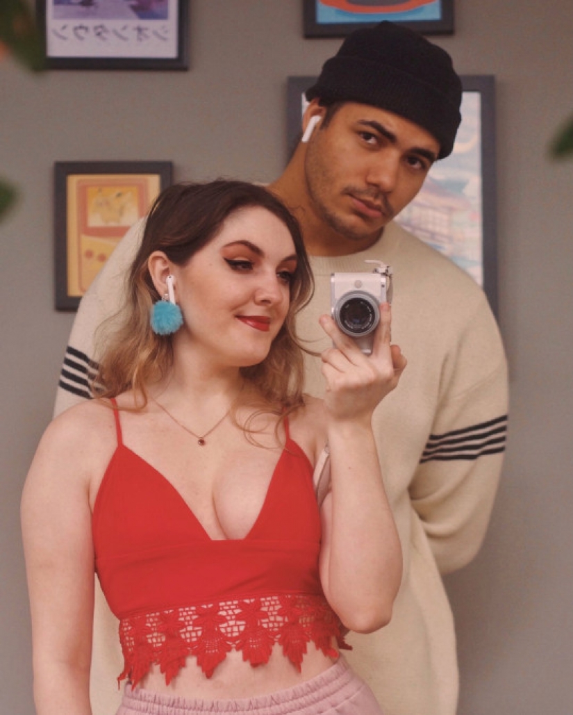 The Englishwoman, due to a rare disease, grew only one breast, but this did not make her unhappy The Englishwoman, due to a rare disease, grew only one breast, but this did not make her unhappy