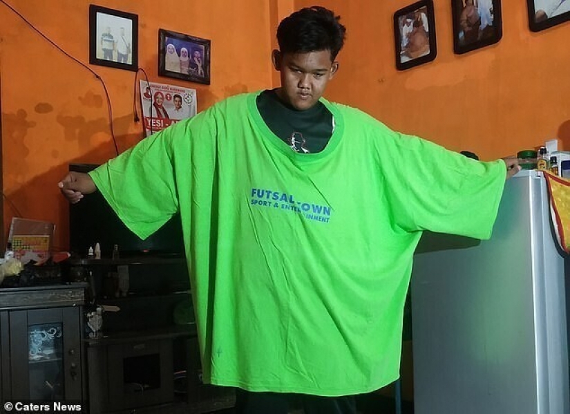 The fattest boy in the world lost beyond recognition: so it now looks