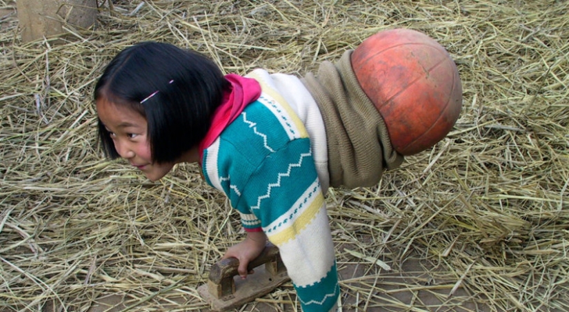 The national heroine of China: a girl with a basketball instead of legs became a famous athlete The national heroine of China: a girl with a basketball instead of legs became a famous athlete