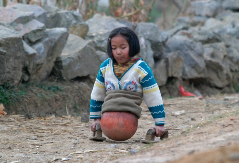 The national heroine of China: a girl with a basketball instead of legs became a famous athlete The national heroine of China: a girl with a basketball instead of legs became a famous athlete