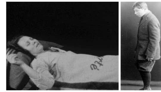 The Sleeping Sickness Epidemic: a strange disease that turned people into living zombies