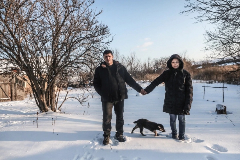 The story of Ani boldyrevoy, which has lost face because of the fire, but hopes for a better life The story of Ani boldyrevoy, which has lost face because of the fire, but hopes for a better life