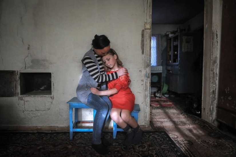The story of Ani boldyrevoy, which has lost face because of the fire, but hopes for a better life The story of Ani boldyrevoy, which has lost face because of the fire, but hopes for a better life