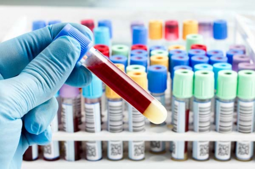 The woman-a detective specializing in unfaithful spouses, shared the secrets of revelations The woman-a detective specializing in unfaithful spouses, shared the secrets of revelations