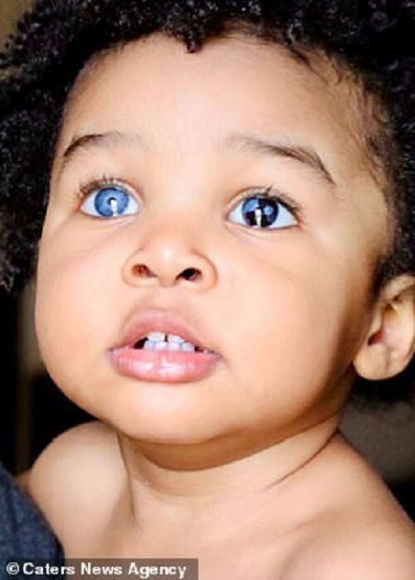 This American woman and her little son conquered the Internet with their unusual eyes This American woman and her little son conquered the Internet with their unusual eyes