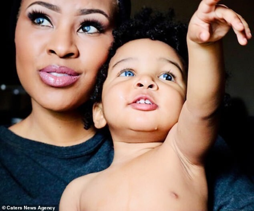 This American woman and her little son conquered the Internet with their unusual eyes This American woman and her little son conquered the Internet with their unusual eyes