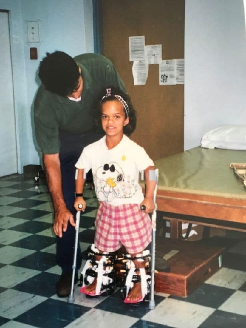 Through pain - to a dream: an American dwarf underwent complex operations for many years to grow up Through pain - to a dream: an American dwarf underwent complex operations for many years to grow up