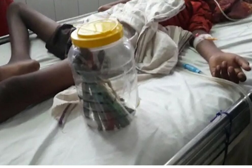 Un joven indio comía cepillos de dientes y uñas para curar la adicción