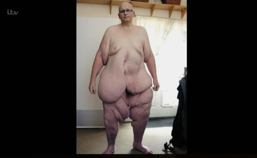 Una carga en el corazón: la triste historia de una de las personas más gordas del mundo Una carga en el corazón: la triste historia de una de las personas más gordas del mundo