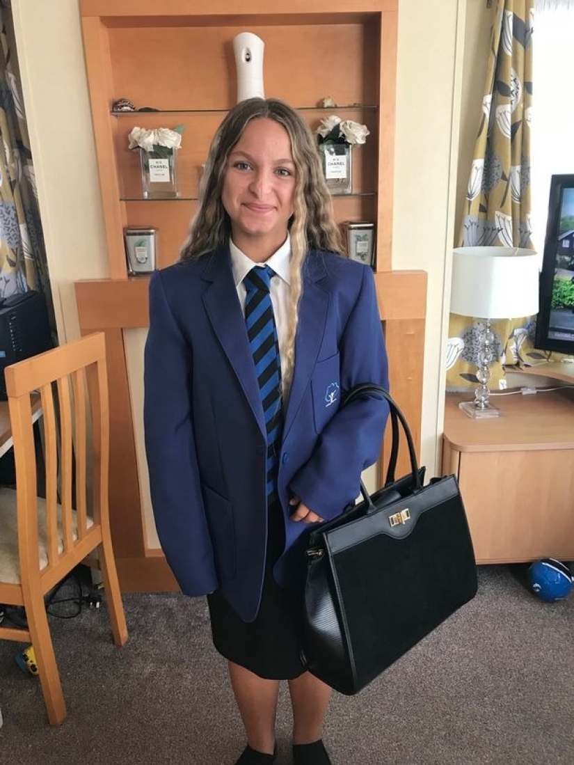 Una joven británica que nació con una mancha en la nariz ayuda a las personas con defectos en la apariencia