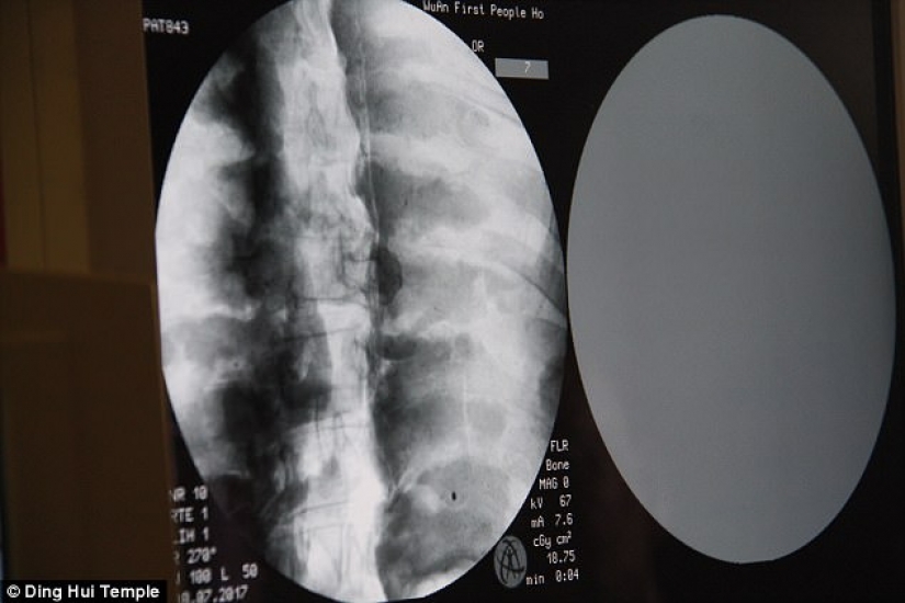 Una momia milenaria de un monje budista tiene un cerebro y un esqueleto preservados en perfecto estado Una momia milenaria de un monje budista tiene un cerebro y un esqueleto preservados en perfecto estado