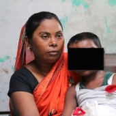 Una niña con dos narices en la India es considerada la encarnación de una deidad