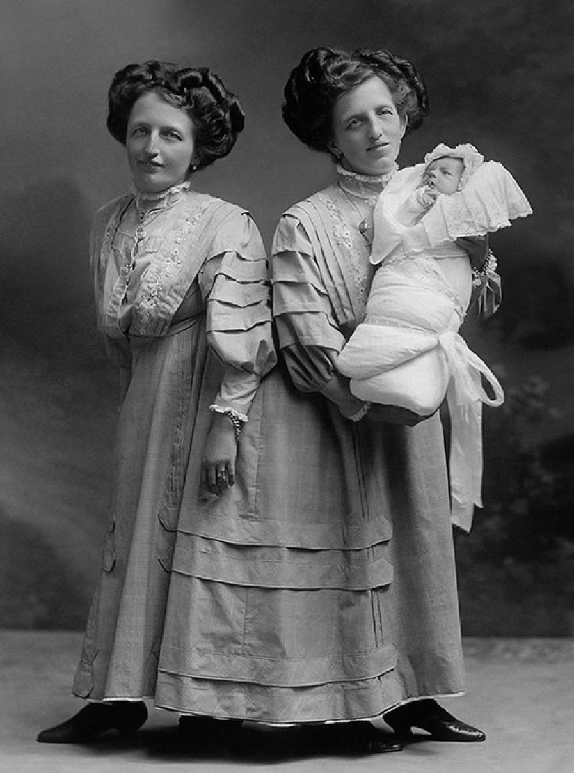 Una vida para dos personas sin tensión y tragedias: una feliz gemelos Siameses