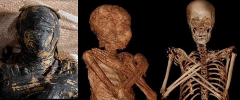 Unique find: Egyptian mummy turned out to be pregnant Unique find: Egyptian mummy turned out to be pregnant