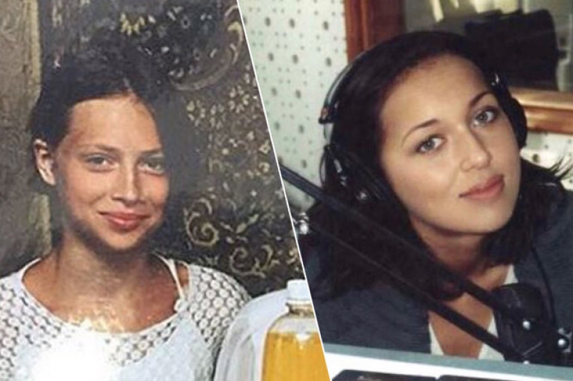 Valeria, Anastasia Zavorotnyuk y otras 8 estrellas que demostraron que no hicieron cirugía plástica