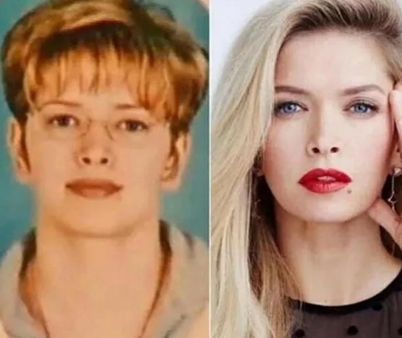 Valeria, Anastasia Zavorotnyuk y otras 8 estrellas que demostraron que no hicieron cirugía plástica