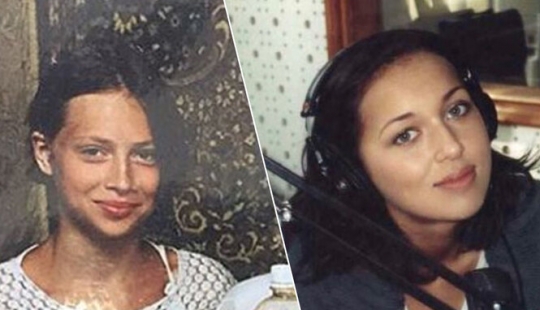 Valeria, Anastasia Zavorotnyuk y otras 8 estrellas que demostraron que no hicieron cirugía plástica