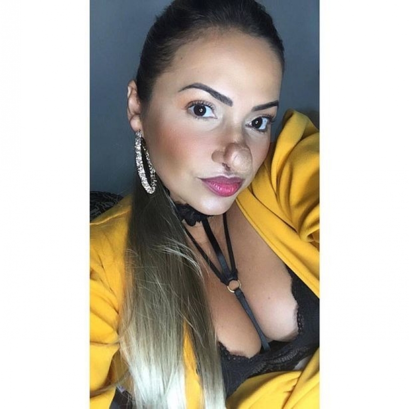 "Vaya, Pinocho!": una mujer brasileña ha aprendido a amarse a sí misma, a pesar de una nariz enorme "Vaya, Pinocho!": una mujer brasileña ha aprendido a amarse a sí misma, a pesar de una nariz enorme