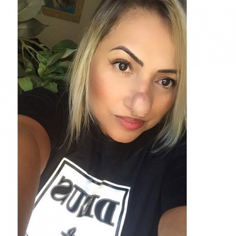 "Vaya, Pinocho!": una mujer brasileña ha aprendido a amarse a sí misma, a pesar de una nariz enorme "Vaya, Pinocho!": una mujer brasileña ha aprendido a amarse a sí misma, a pesar de una nariz enorme