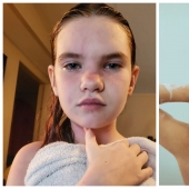 Water-trouble: a schoolgirl from Louisiana may die after taking a shower