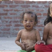 Why do brother and sister from India look like little old men