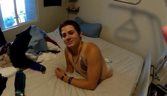 Winner of Death: how a 19-year-old American lives after a lower-body amputation