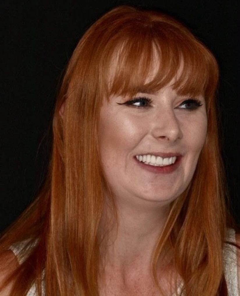 With a smile for life: how a girl transformed with terrible teeth