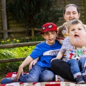 With faith in the best: a 4-year-old boy with a tumor on his face does not lose heart, despite the disease