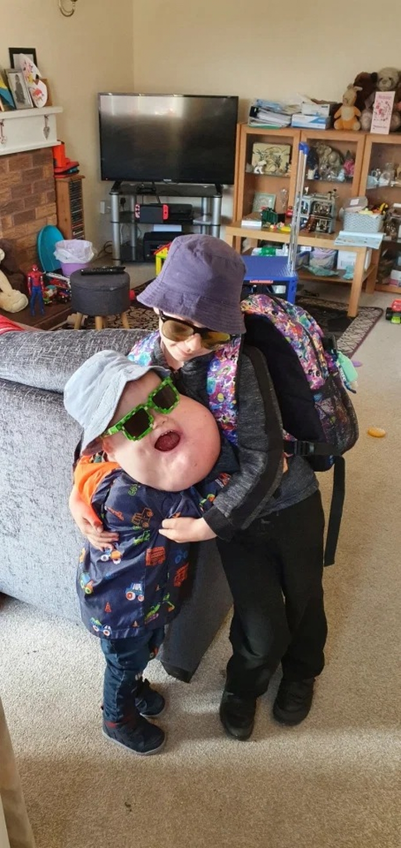 With faith in the best: a 4-year-old boy with a tumor on his face does not lose heart, despite the disease