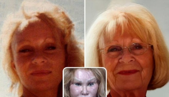 With the help of artificial intelligence, we learn how to look at these celebrities without plastic surgery