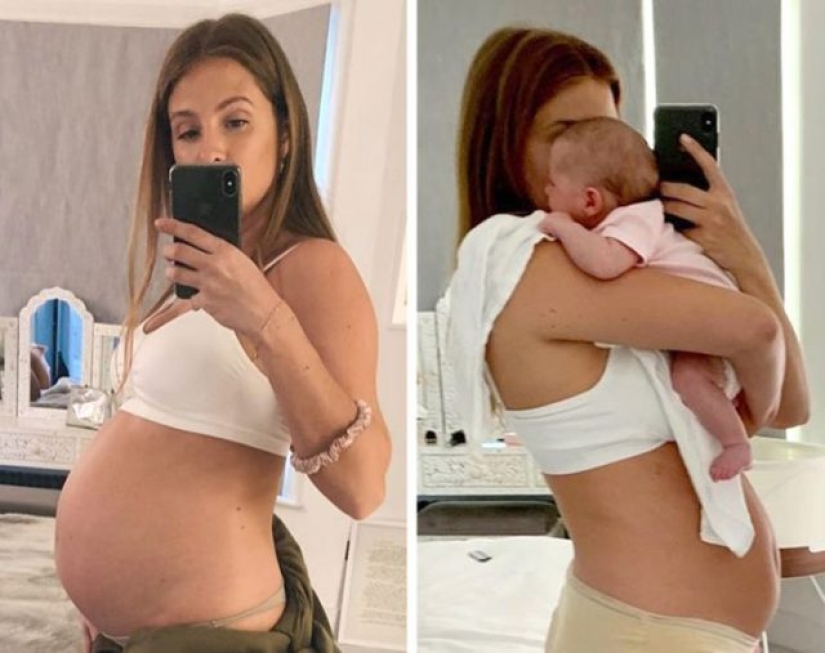 10 Celeb Moms Who Proudly Shared Their Postpartum Body With The World 10 Celeb Moms Who Proudly Shared Their Postpartum Body With The World