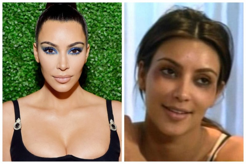 10 celebrities who strongly regretted plastic surgery