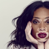 10 chicas que convirtieron sus defectos en fortalezas