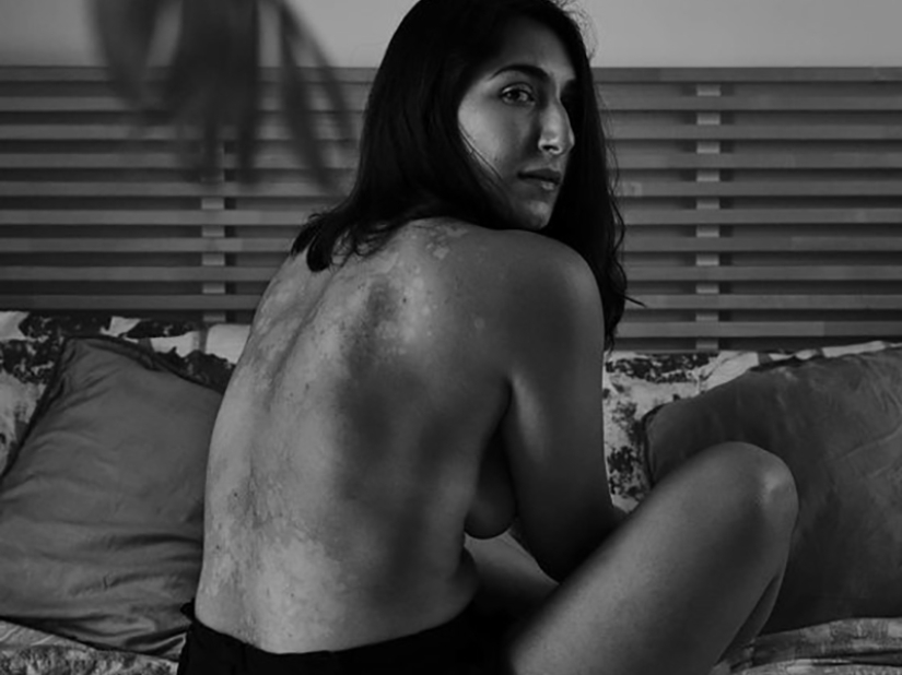 10 chicas que convirtieron sus defectos en fortalezas