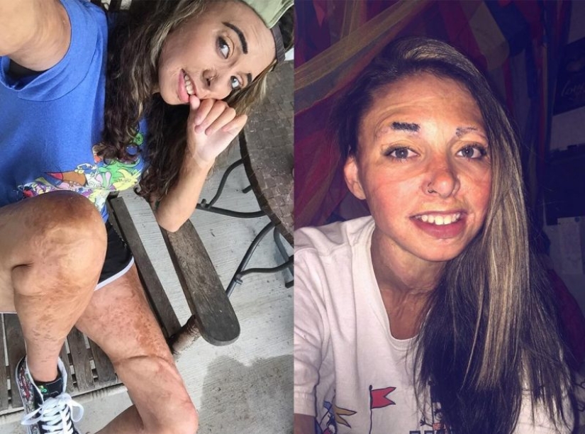 10 chicas que convirtieron sus defectos en fortalezas