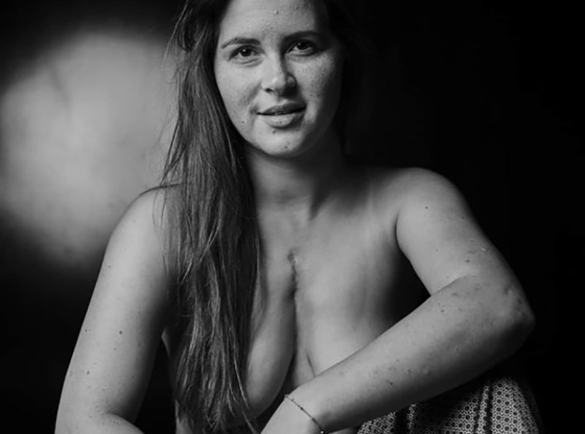 10 Girls Who Turned Their Flaws Into Strengths