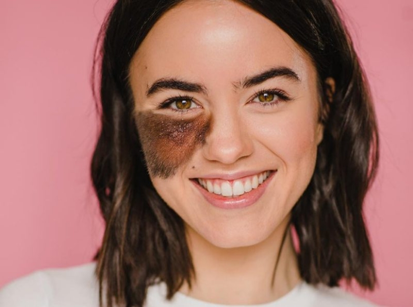 10 Girls Who Turned Their Flaws Into Strengths