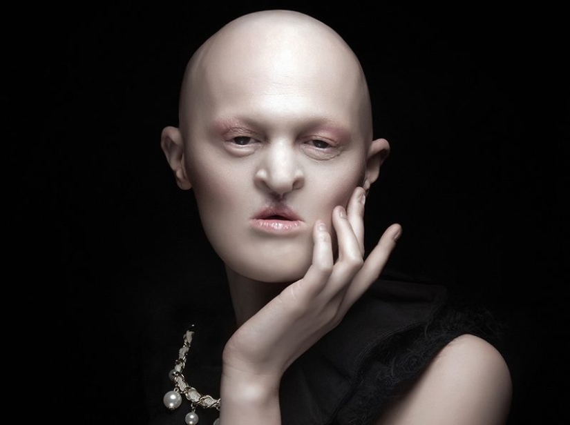 10 Girls Who Turned Their Flaws Into Strengths