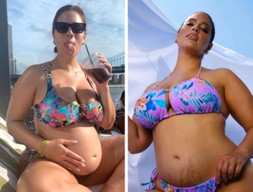 10 mamás famosas que orgullosamente compartieron su cuerpo posparto con el mundo