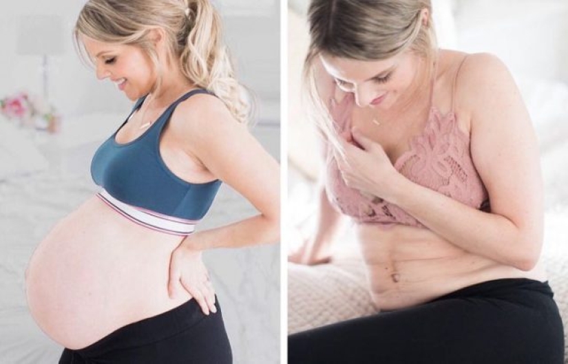 10 mamás famosas que orgullosamente compartieron su cuerpo posparto con el mundo